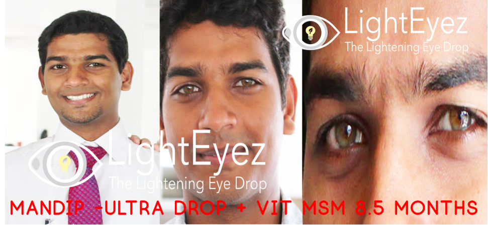 You are currently viewing Light Eyez Eye Drops – Eye Drops for Nearly Every Purpose